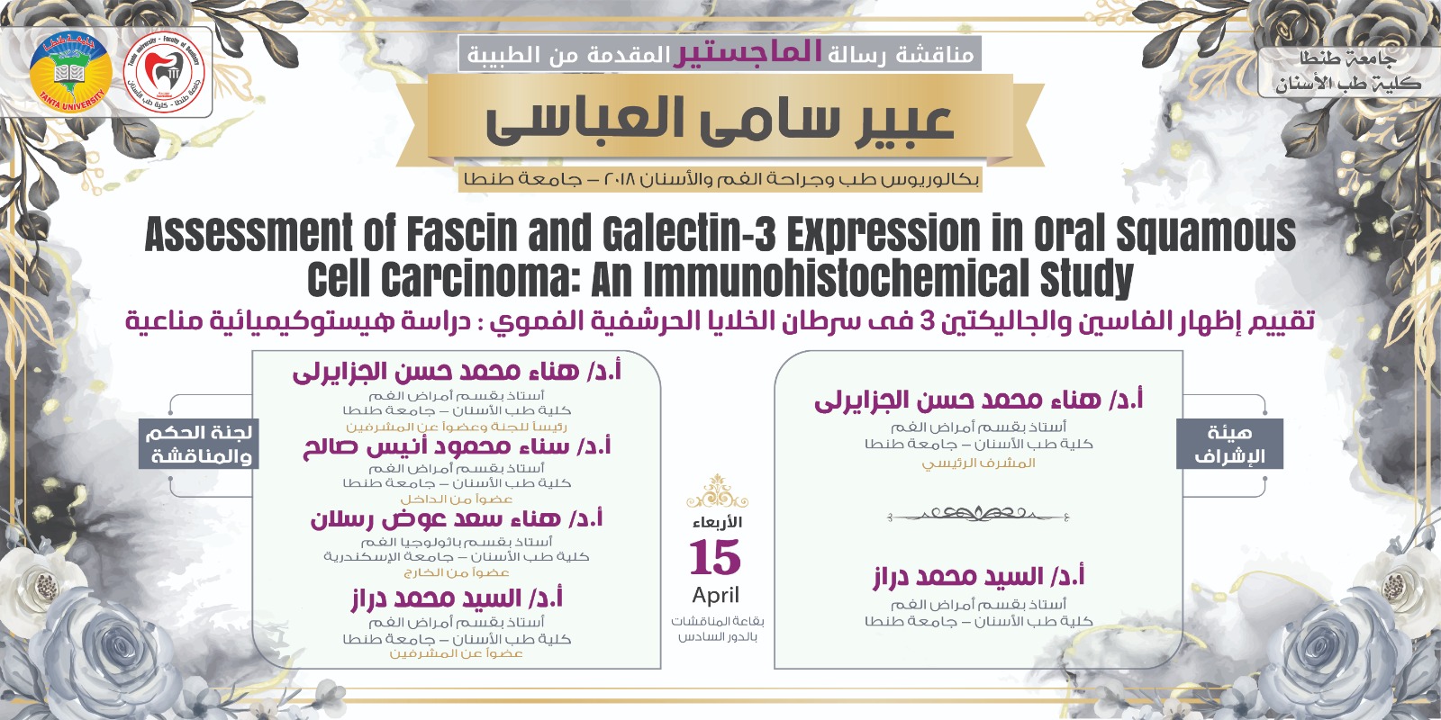 الإعلان عن موعد انعقاد المناقشة العلنية لرسالة ماجستير الطبيبة عبير سامي العباسي الأربعاء المقبل